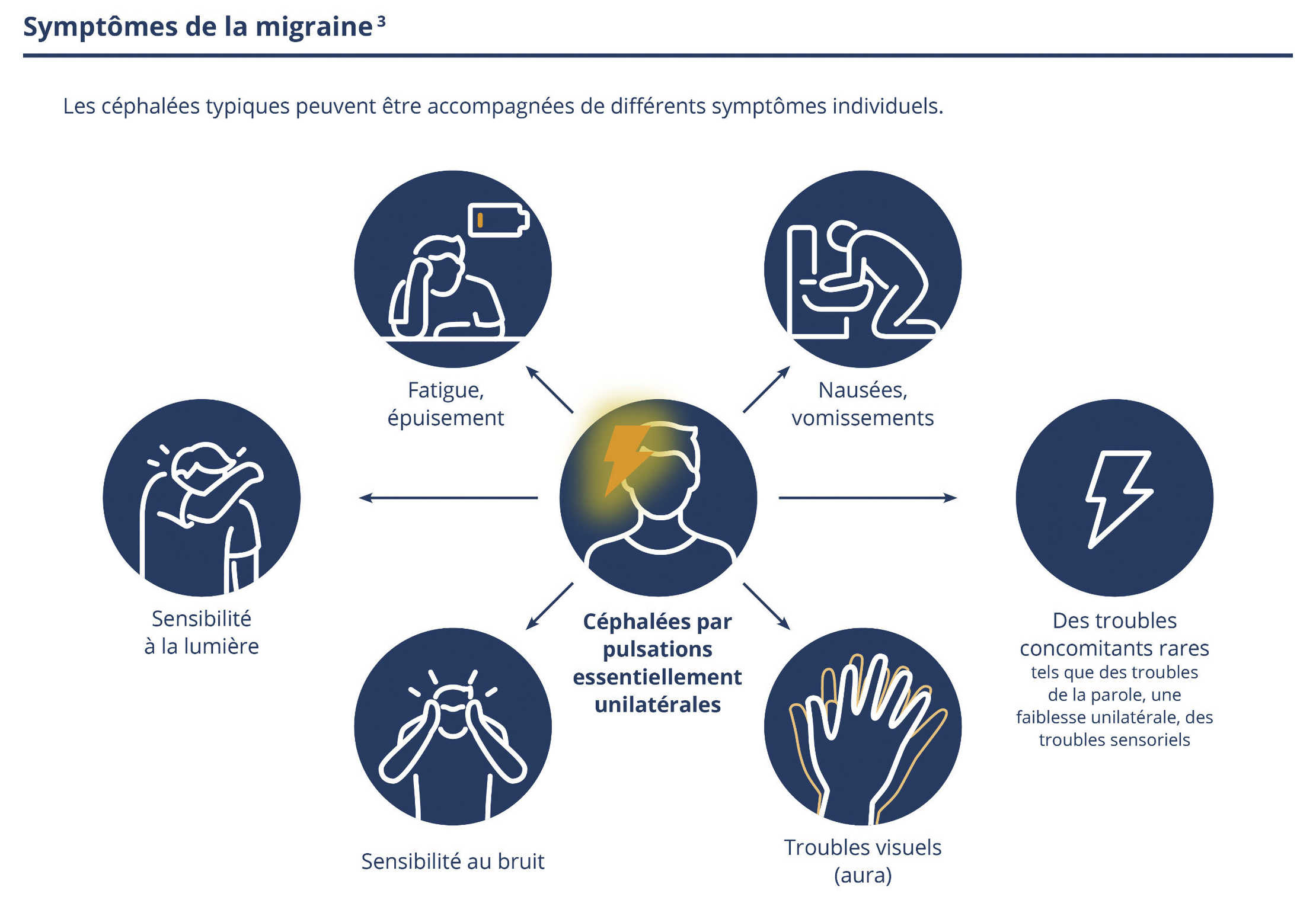 Migraine: le schéma montre les symptômes de la migraine. Migraine: le schéma montre les symptômes de la migraine.