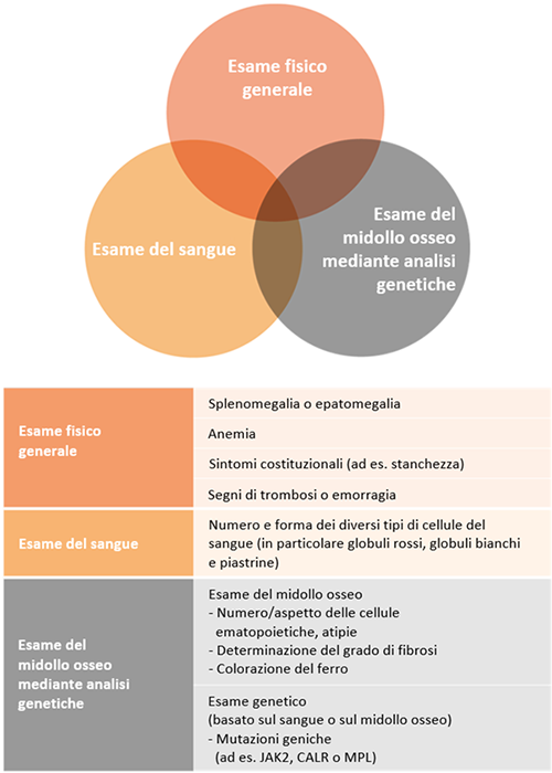 Tre elementi per la diagnosi di mielofibrosi