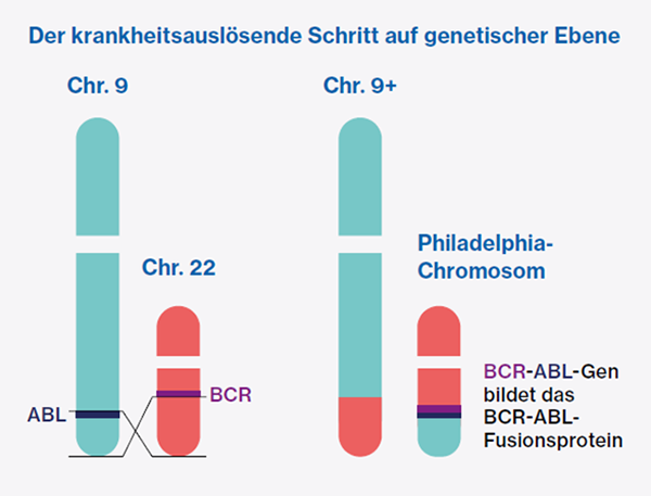 Infographic - Die Entstehung des Philadelphia-Chromosoms