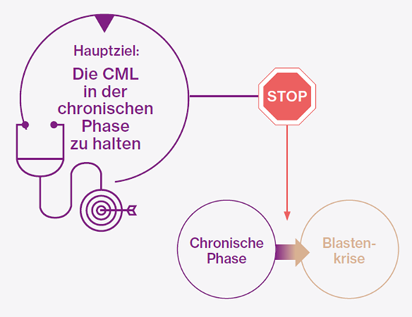 INfographic - Wie wird CML behandelt