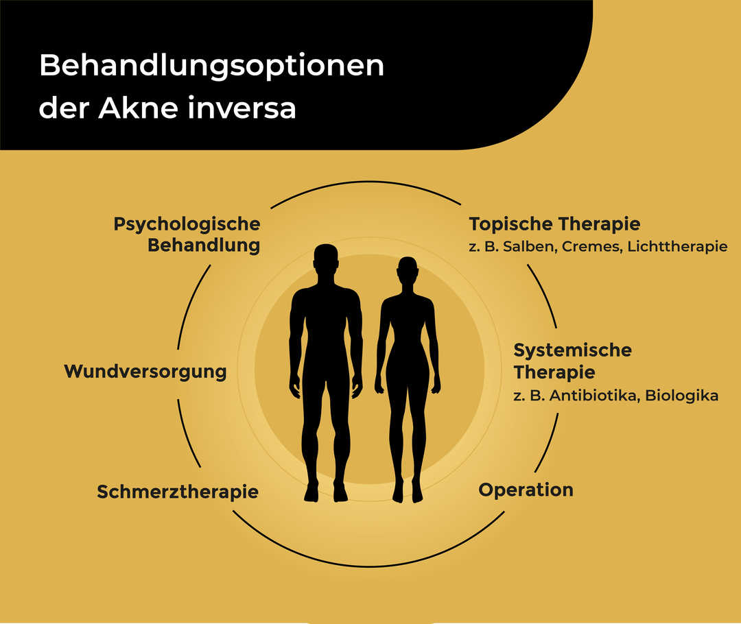 Akne inversa: Behandlungsoptionen Zwei schematisch dargestellte Menschen, über denen die Überschrift «Behandlungsoptionen der Akne inversa» steht. Sie sind kreisförmig umgeben von der Beschriftung «Topische Therapie (z. B. Salben, Cremes, Lichttherapie), Systemische Therapie (z. B. Antibiotika, Biologika), Operation, Schmerztherapie, Wundversorgung, Psychologische Behandlung».