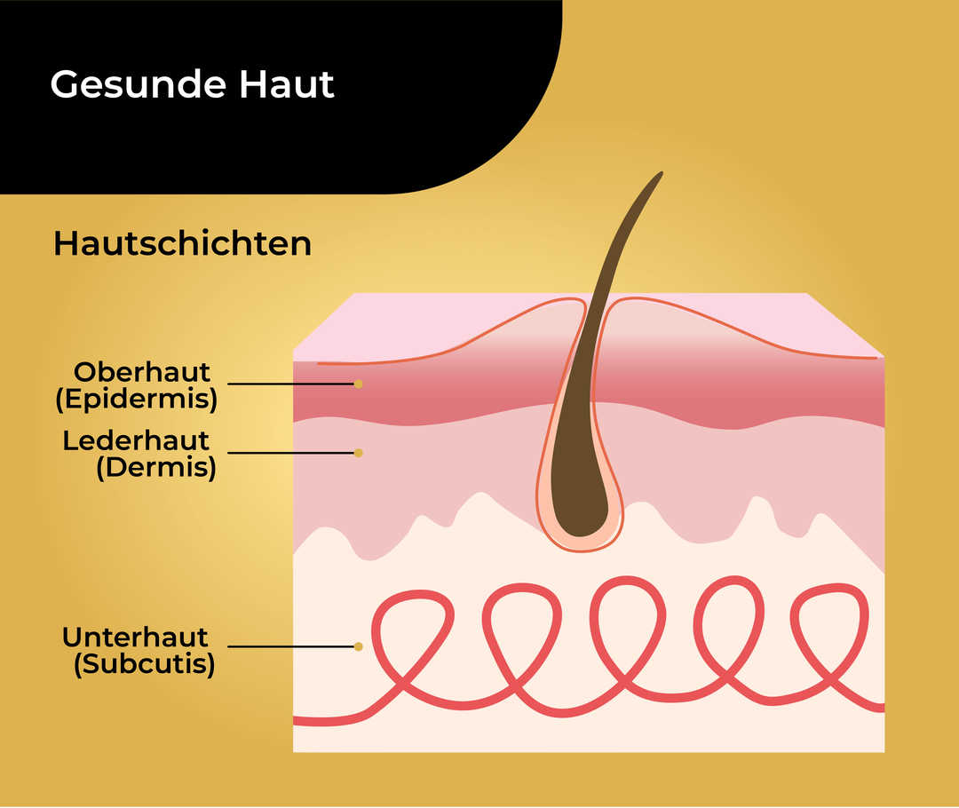 Schematische Darstellung von gesunder Haut mit einem Haar und den umliegenden Hautschichten, die als «Oberhaut (Epidermis), Lederhaut (Dermis) und Unterhaut (Subcutis)» beschriftet sind.