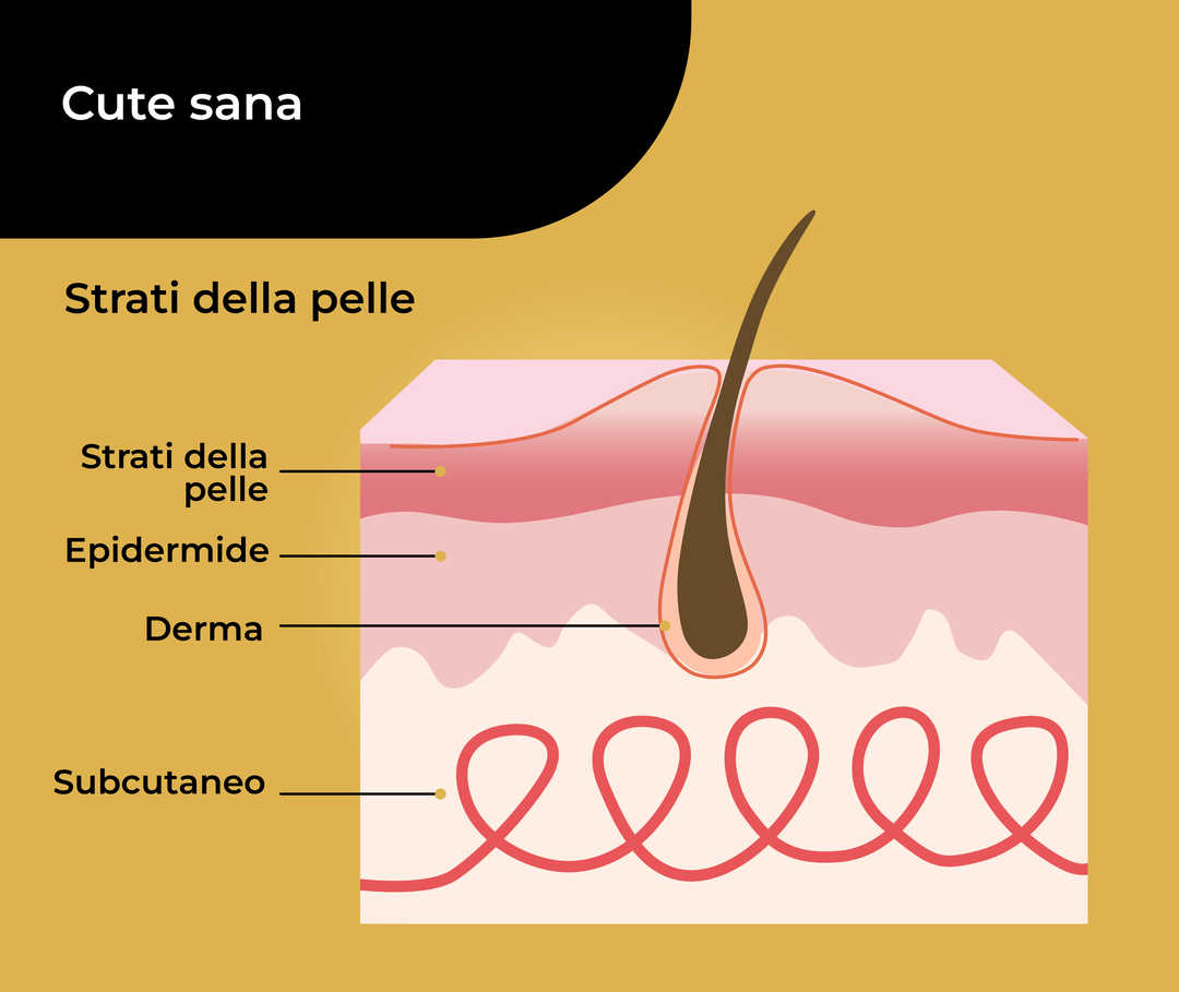 Rappresentazione schematica di una pelle sana con un pelo e gli strati cutanei circostanti denominati «epidermide, derma e sottocute