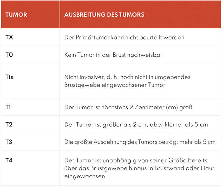 Ausbreitung des Brustkrebses Tabelle, die angibt, wie gross ein Tumor ist und wie weit er sich ausgebreitet hat.