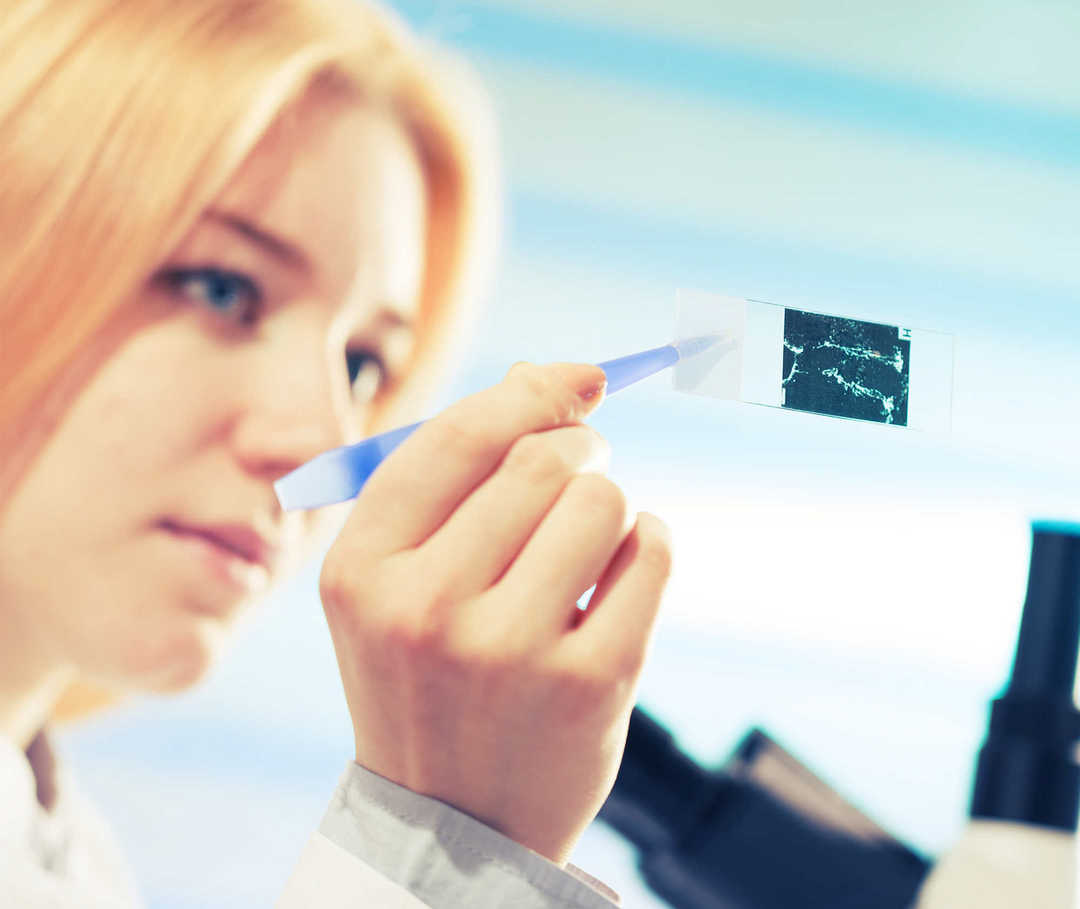 Biopsie bei Brustkrebs Eine Frau legt etwas auf eine Glasscheibe, auf der sich eine gefärbte Gewebeprobe befindet.