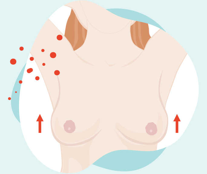 Illustration du torse nu d’une femme. Les bras sont au-dessus de la tête.