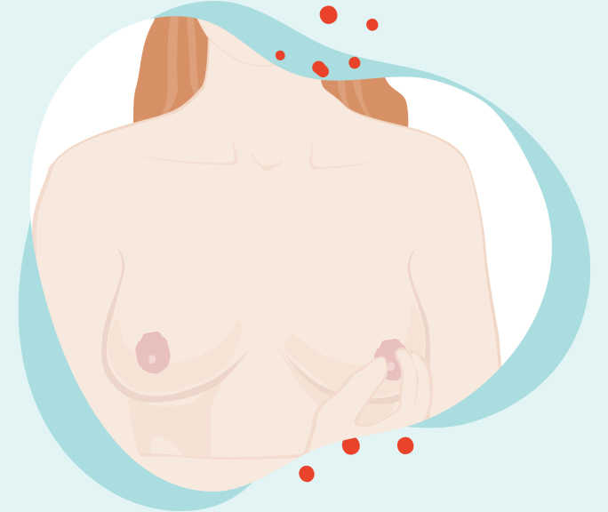 Illustration du torse nu d’une femme. Deux doigts sont sur le mamelon.