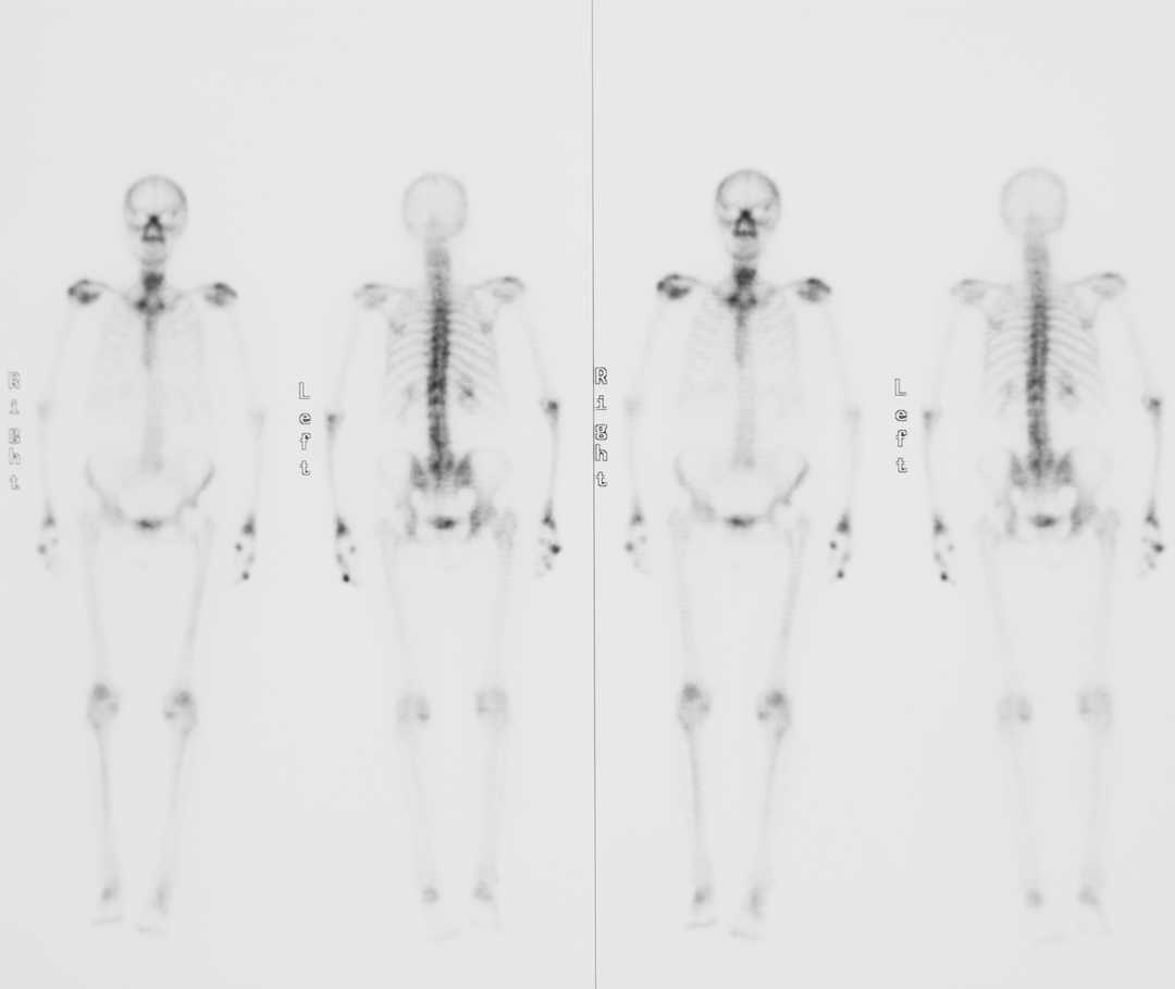Vue d'une image de scintigraphie