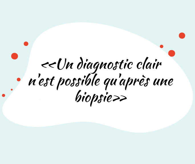 «Un diagnostic clair n'est possible qu'après une biopsie»